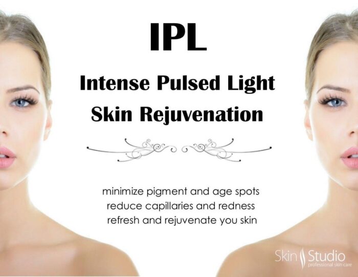 لیزر حذف موی زائد بدن و صورت خانگی ای پی ال مدل Intense Pulsed Light A110